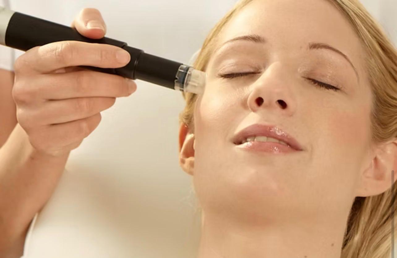 Mikrodermabrasion