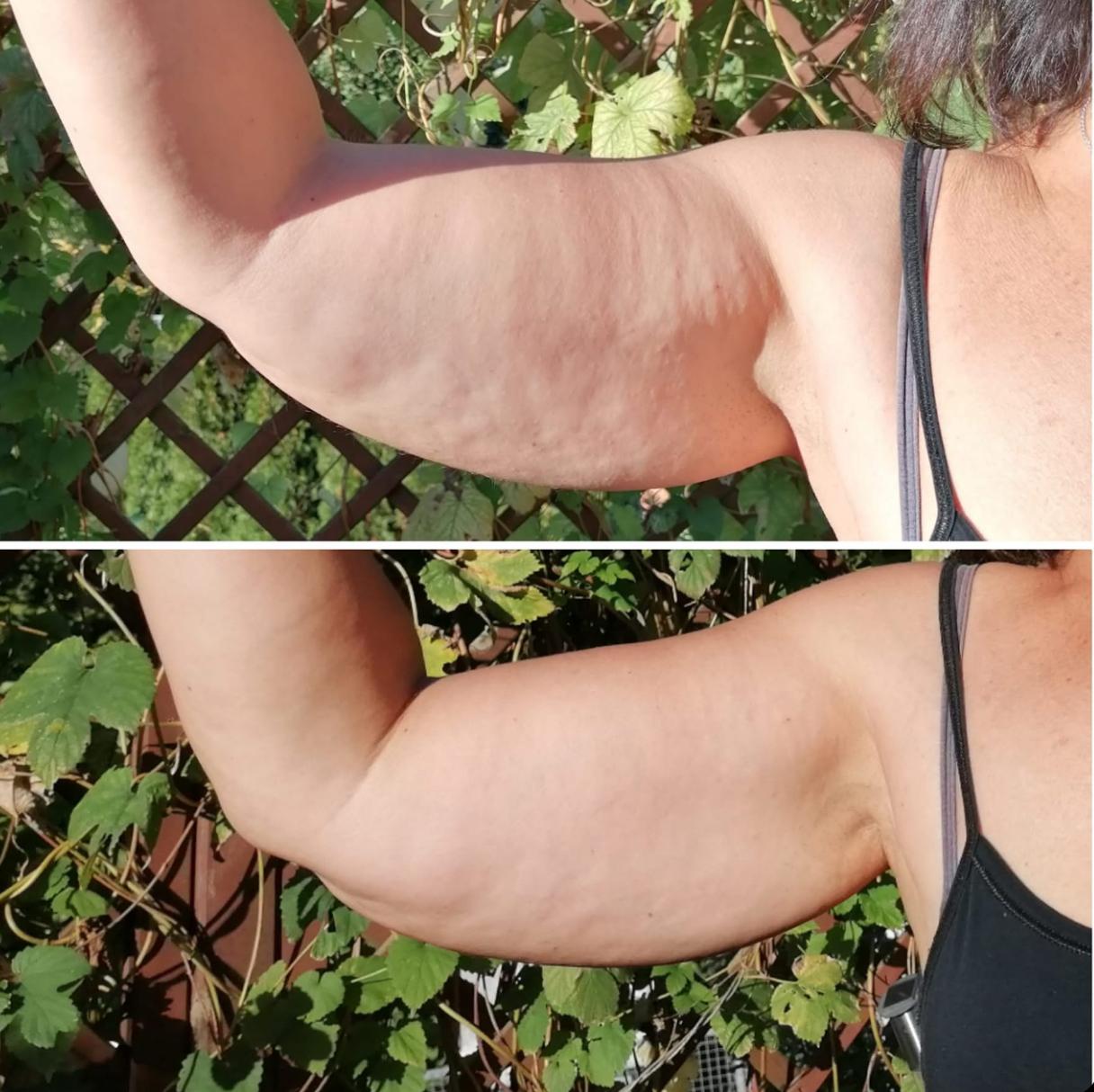 Vorher-Nachher Behandlung